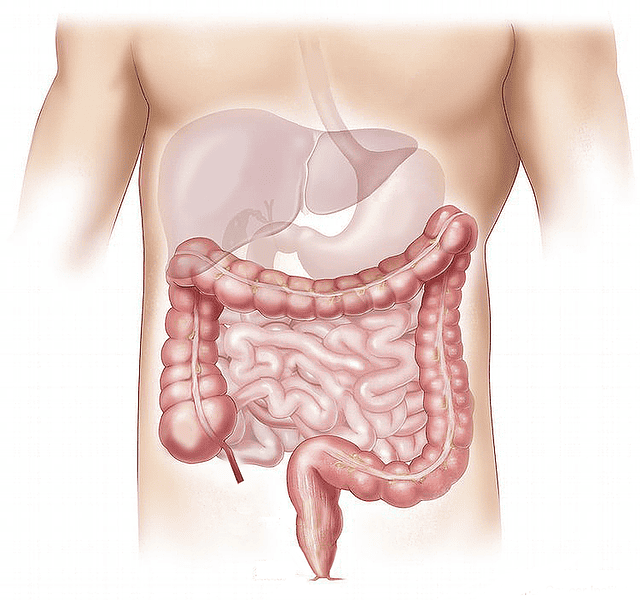 How do you treat gut mold?